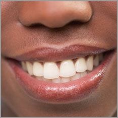 White teeth
