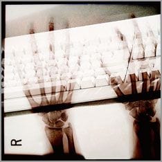 Röntgenbild von zehn fingern und einer Tastatur