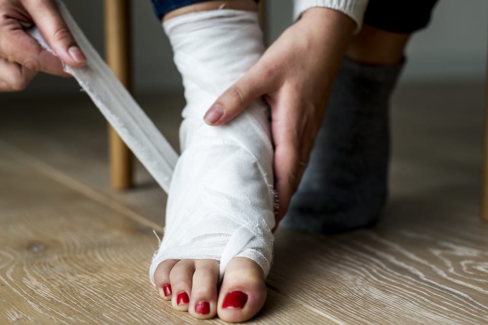 Treatment sprained foot