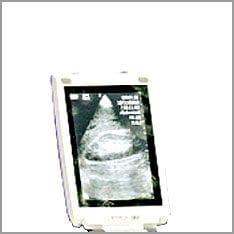 Mobile ultrasound device