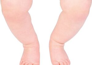 O-legs