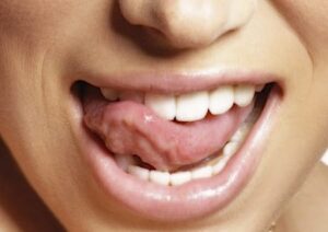 Tongue