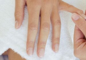 Cross grooves on the fingernails