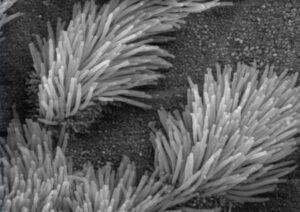 Cilia in the lungs