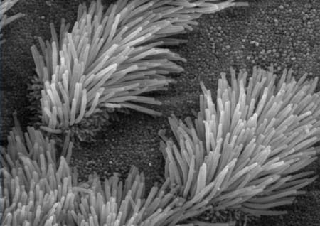 Cilia in the lungs
