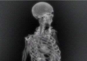 X-ray image of a human body