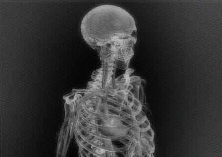 X-ray image of a human body