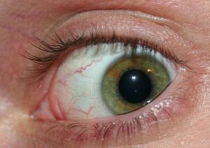 Eye