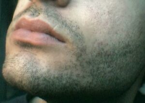 Beard shadow