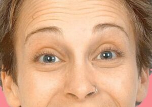 Eye cream
