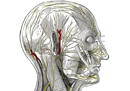 Headache