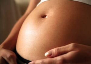 Prevent stretch marks