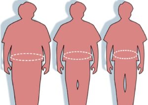 Stomach reduction