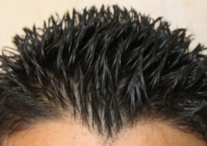 Hair without dandruff